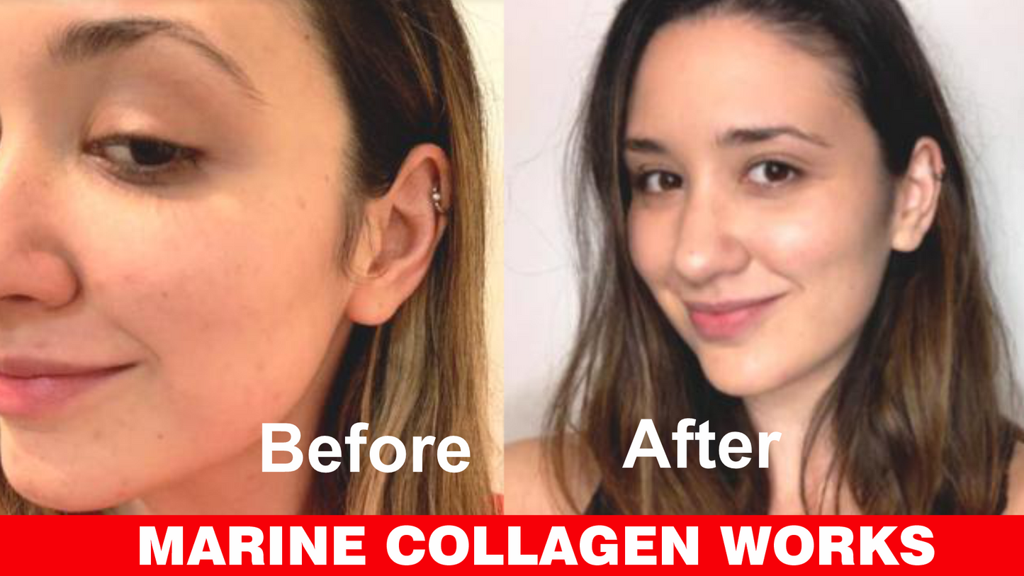 Marine Collagen